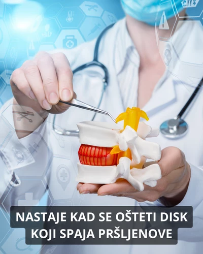 Vežbe za diskus herniju